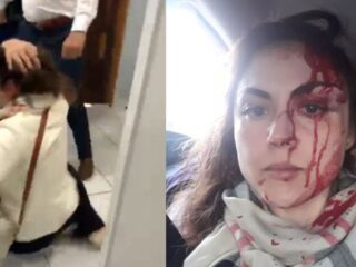 ASSISTA: Procuradora-geral é brutalmente agredida por funcionário