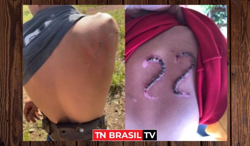 Com ferro em brasa adolescente marca o corpo com o 22 de Jair Bolsonaro na pele