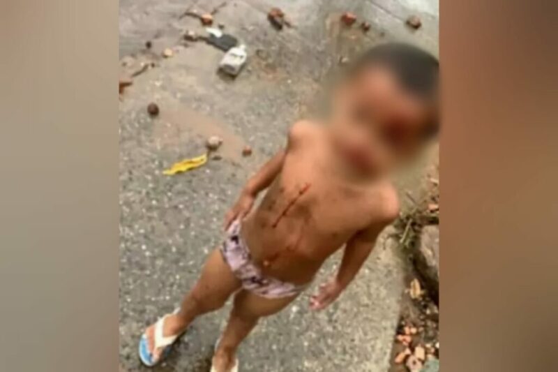 Criança ferida é encontrada caminhando sozinha em rodovia do Pará