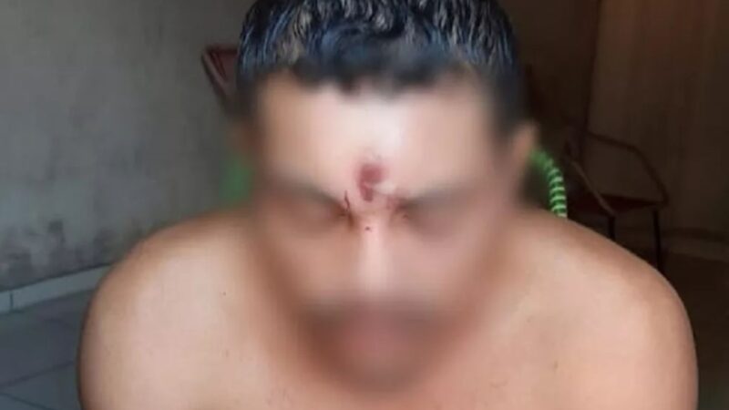 Homem leva tiro na testa, cai da moto e vai para casa dormir