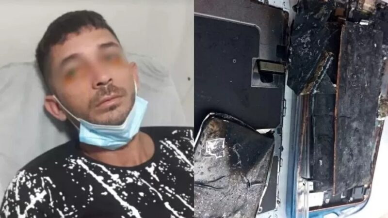 iPhone explode e jovem de 28 anos perde parte da visão