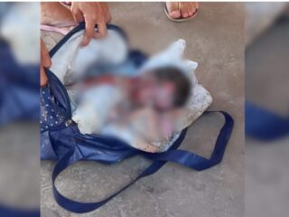 Mulher faz seu próprio parto na rua e anda com bebê morto dentro de bolsa, em Belém