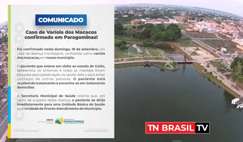 Prefeitura de Paragominas confirma o primeiro caso de varíola dos macacos