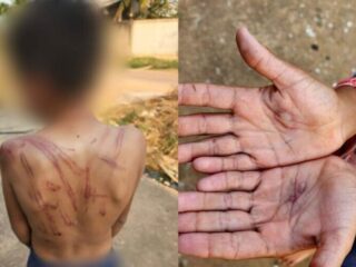 Mãe espanca e queima filho por causa de 10 reais no Pará