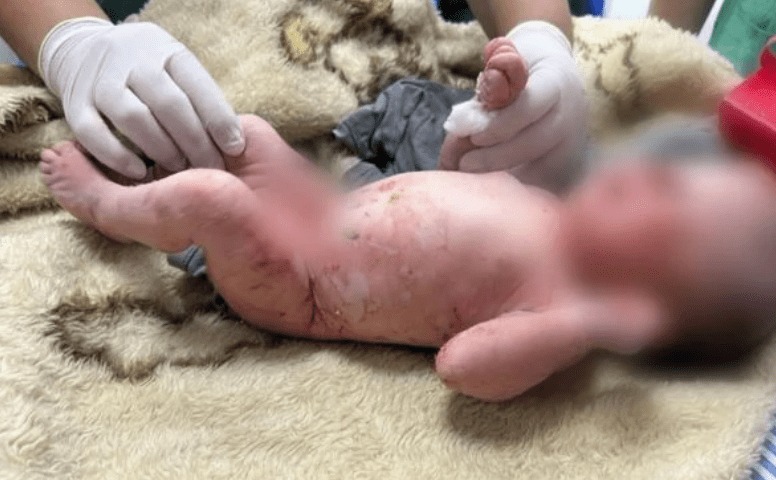 Recém-nascida é encontrada dentro de um saco de lixo em Goiás