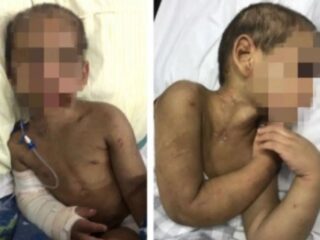 Mãe e padrasto quebram oito costelas de criança por causa de ‘bagunça’ em SP
