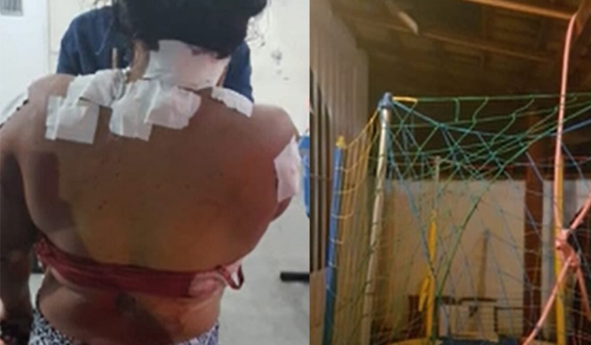 Grávida esfaqueada se joga do 2º andar para se salvar de ex-companheiro e cai em pula-pula