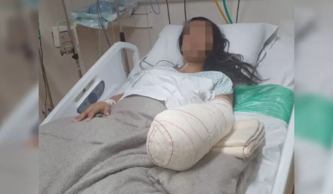 Mulher vai para hospital dar à luz e volta com mão e punho amputados no RJ