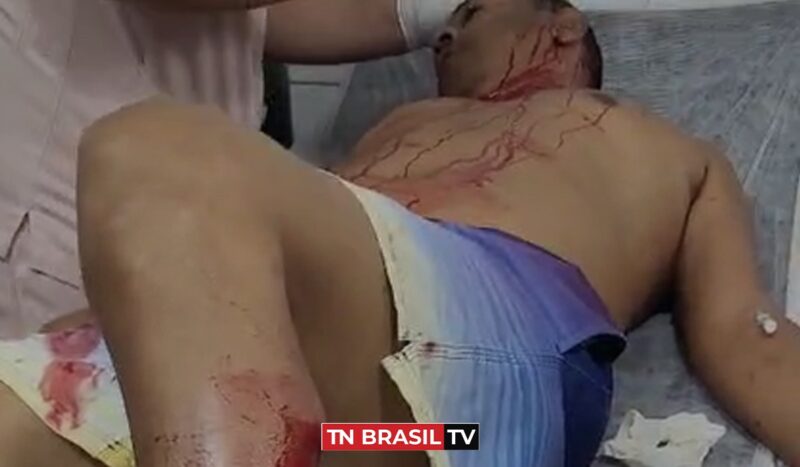 Vereador Regis Santana é baleado em Nova Ipixuna, no Pará