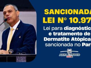 Coronel Neil: Lei para diagnóstico e tratamento de Dermatite Atópica é sancionada no Pará