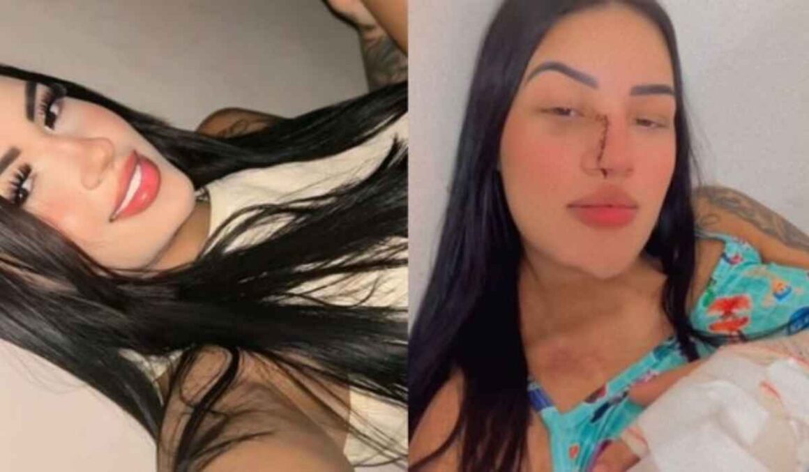 IMAGENS FORTES: Influencer quase teve dedos decepados por mulheres em show