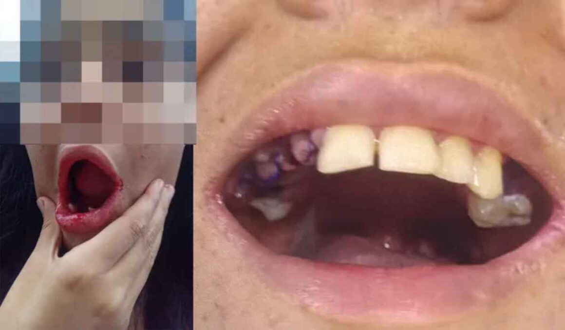 Governador Helder Barbalho afasta médico que extraiu 17 dentes de jovem autista