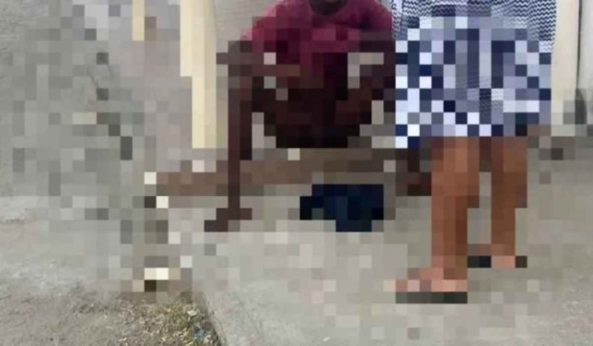 Imagens Fortes: jovem tem partes íntimas arrancadas por pitbull ao tentar pular muro