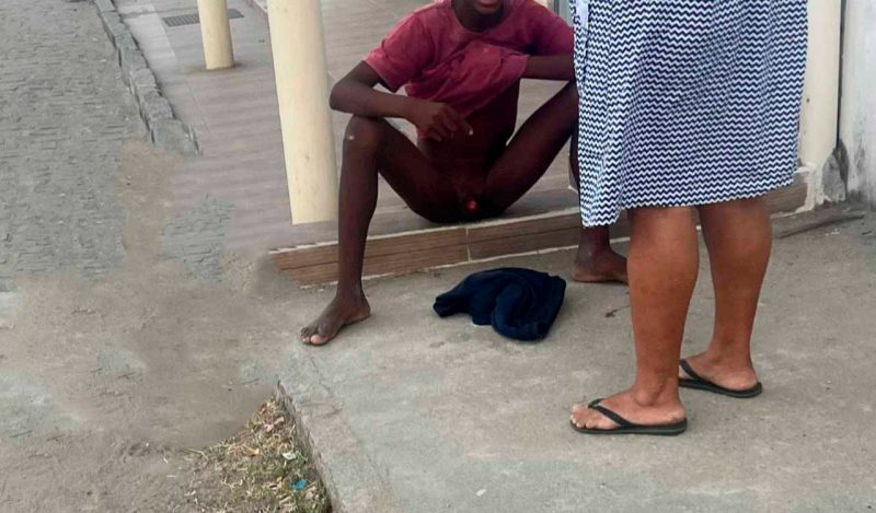 Imagens Fortes: jovem tem partes íntimas arrancadas por pitbull ao tentar pular muro