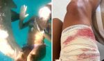 Vídeo: Turista é mordida por tubarão durante mergulho em Fernando de Noronha