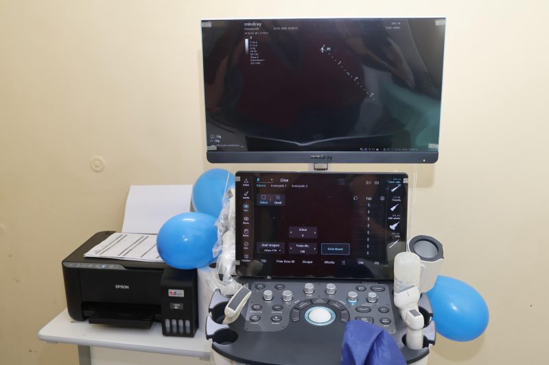 Emenda parlamentar da deputada Paula Titan garante novos aparelhos de ultrassom para Cametá