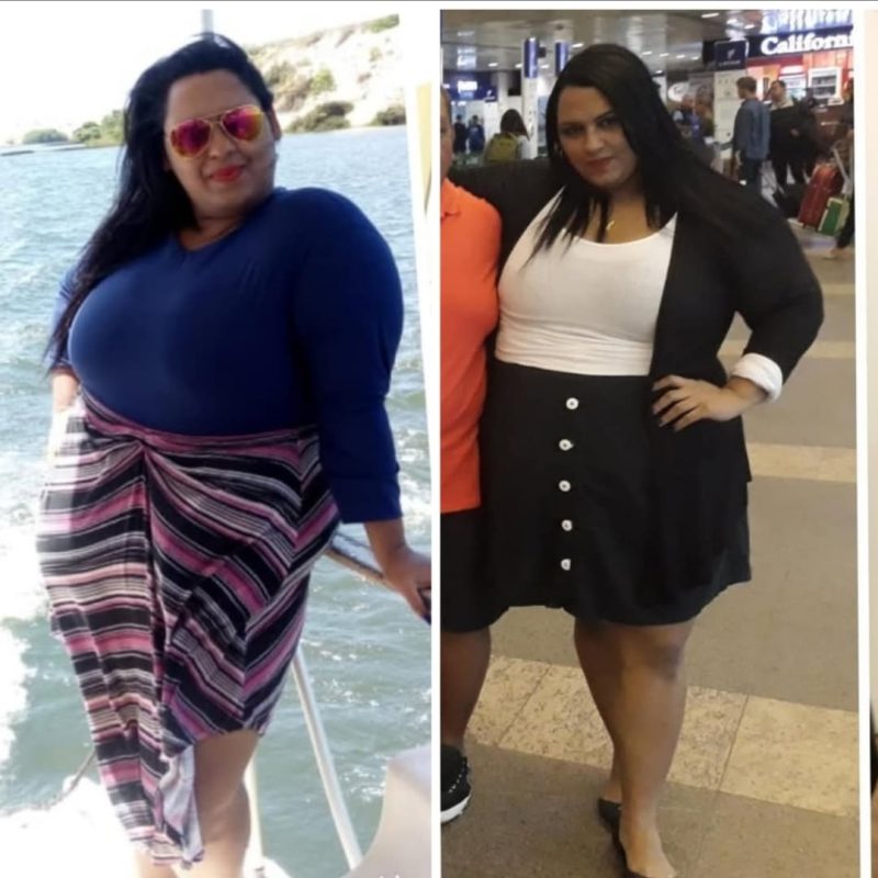 A advogada que perdeu 90 kg e hoje defende vidas através do Direito da Saúde