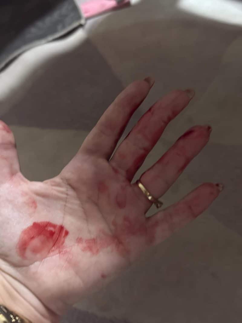 12 boletins de ocorrência: medidas protetivas falham e advogada vive rotina de medo em Goiânia